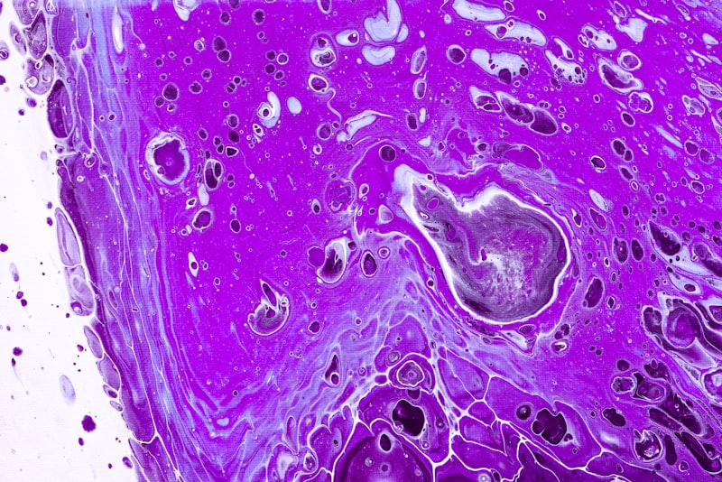 Mammary Fibroblasts Secrete Damage Associated Molecular Patterns through Extracellular Vesicles in Response to Ionizing Radiation